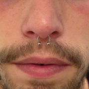Septum
