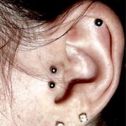 double tragus