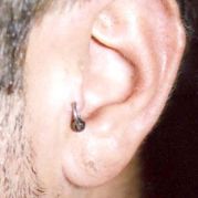 tragus