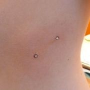 Microdermal