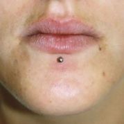 Labret