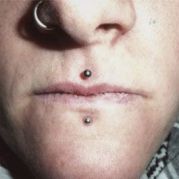 Labret + Médusa